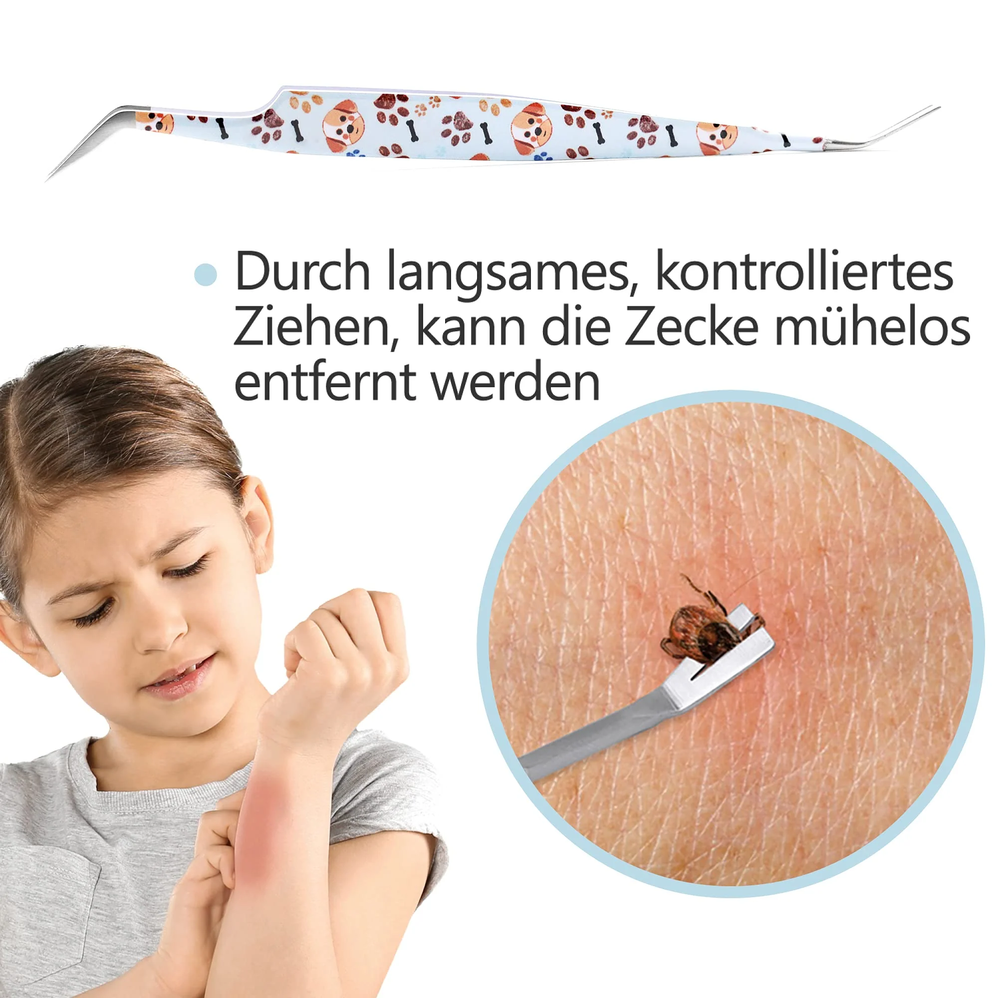 2-in-1 Profi Zeckenzange - für Hunde und Katzen - Hellblau - Image 3