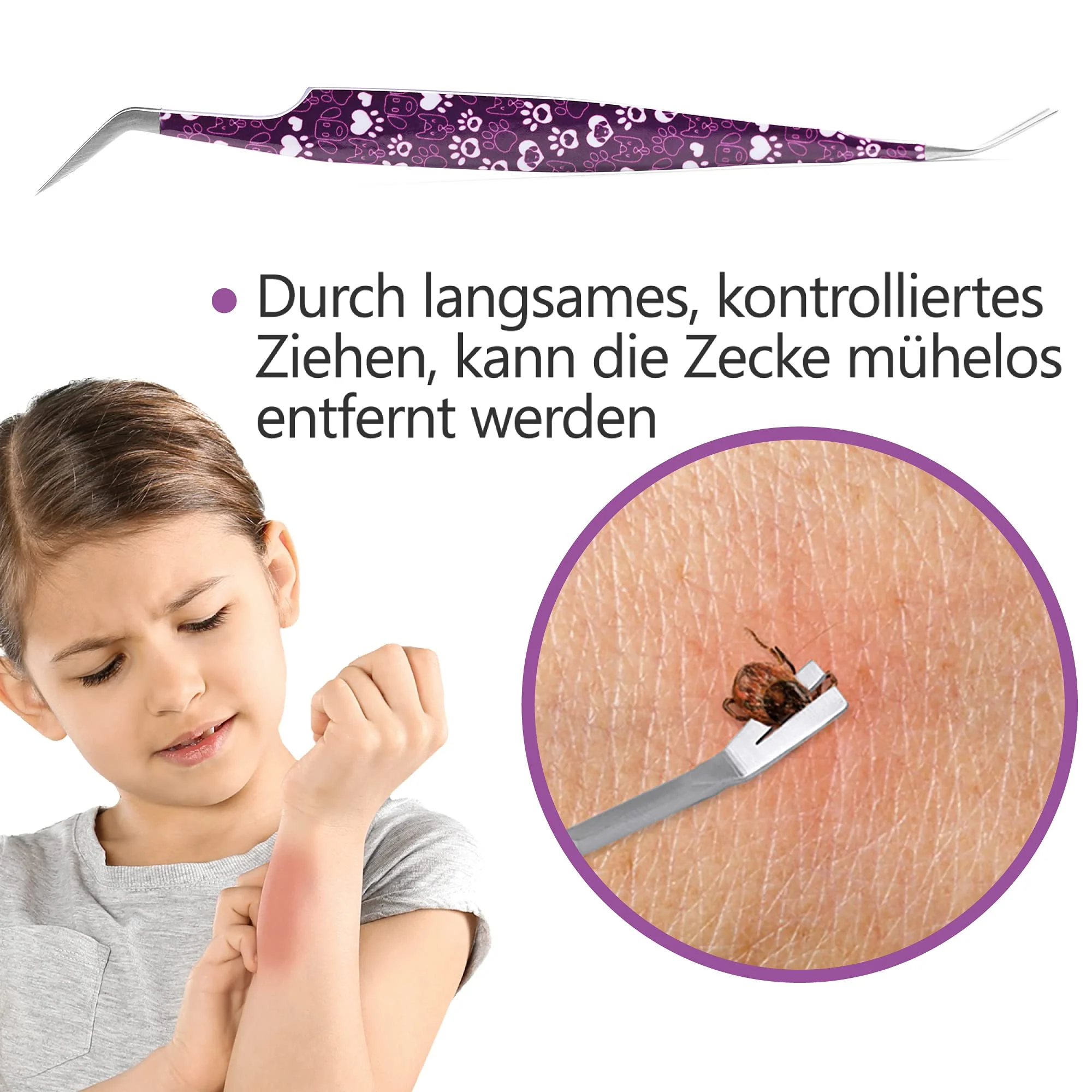 2-in-1 Profi Zeckenzange - für Hunde und Katzen - Violett - Image 3