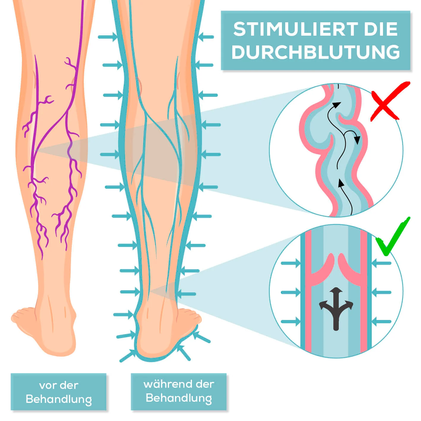 Therapiegerät VenenWalker Pro2 - Image 3