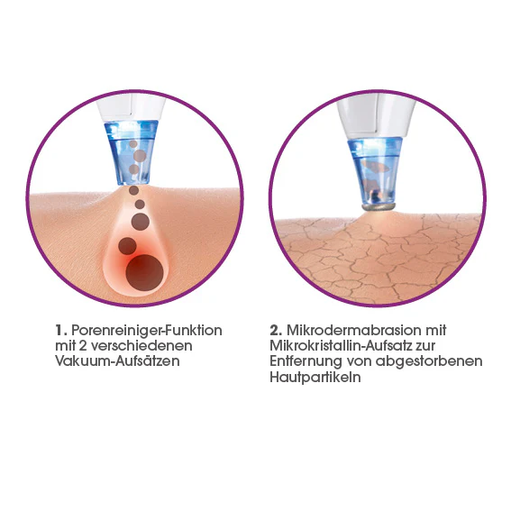 Porenreiniger 5-tlg. mit Aufsatz für Mikrodermabrasion - Image 13
